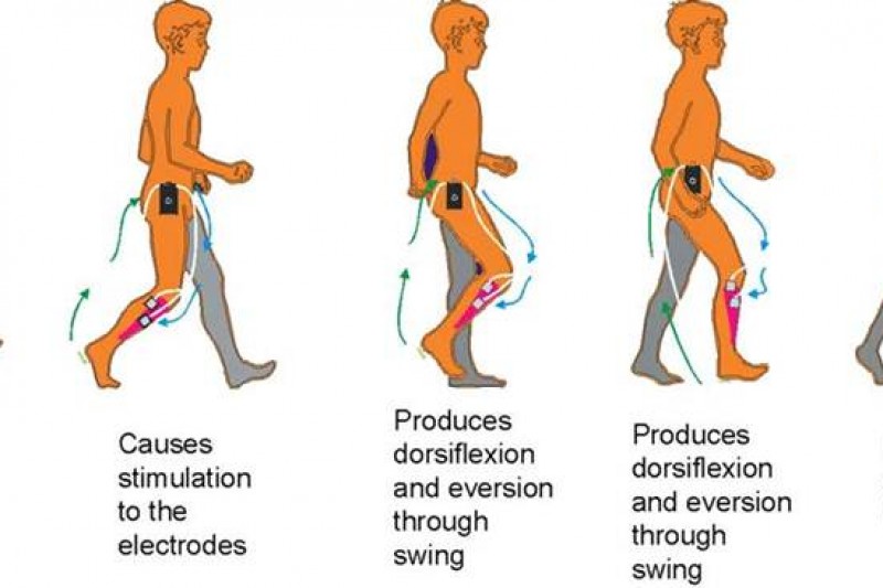 What Is Electrical Muscle Stimulation? - Spine & Rehabilitation Centers